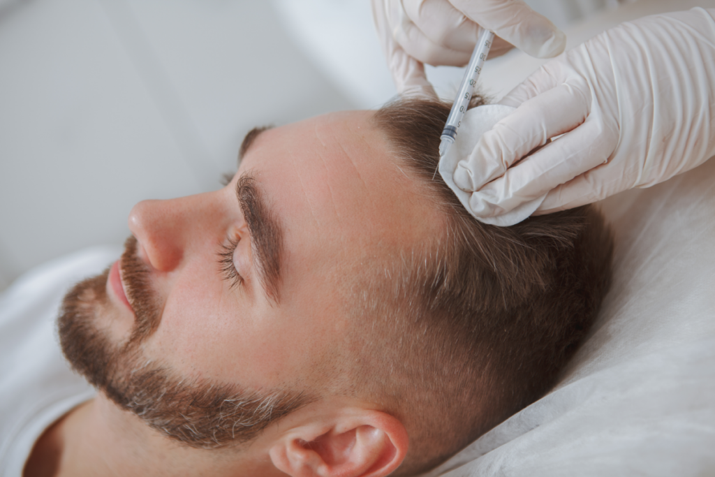 The Science Behind PRP Therapy for Skin and Hair 1