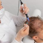 stem cell vs FUE Treatment